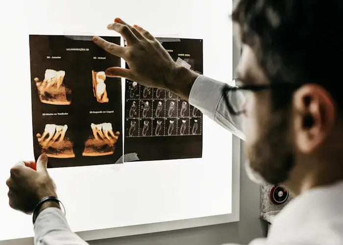 Medicul explică radiografia dentară